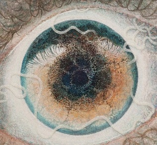 Augenparasiten