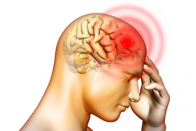 Kopfschmerzen können ein Symptom von Madenwurmlarven im Mittelohr sein. 